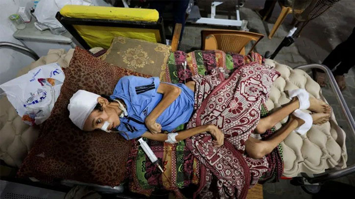 গাজায় অনাহারে নবজাতক শিশুসহ একদিনে ১৫ জনের মৃত্যু