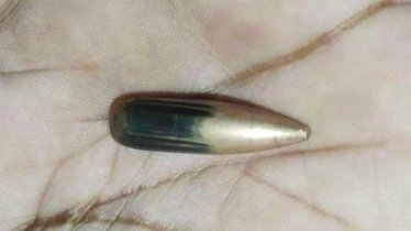 রাখাইনে গোলাগুলি, এপারে গুলিবিদ্ধ নারী রাখাইনে গোলাগুলি, এপারে গুলিবিদ্ধ নারী