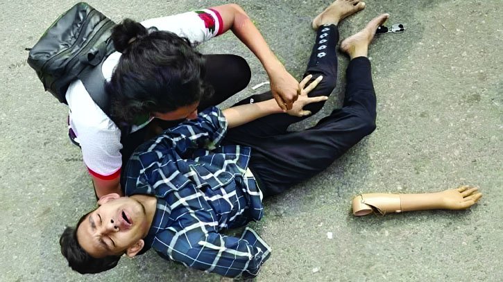 ‘আমার কৃত্রিম হাতটা ওরা ভেঙে ফেলেছে’ ‘আমার কৃত্রিম হাতটা ওরা ভেঙে ফেলেছে’