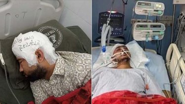 চবি শিক্ষার্থী মামুনের মাথার খুলি রাখা হয়েছে ফ্রিজে, জ্ঞান ফেরেনি সায়েমের
