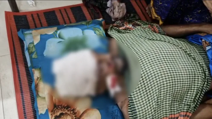 নবীনগরে মাছ ধরা নিয়ে প্রতিপক্ষের হামলায় নারীসহ আহত- ৩