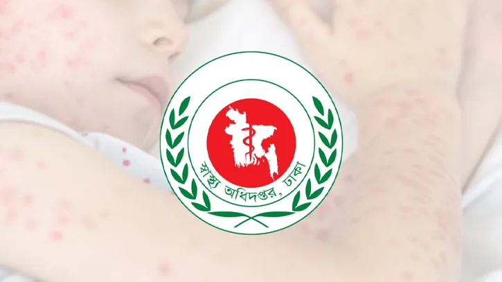২৪ ঘণ্টায় হাম উপসর্গে প্রাণগেল আরও ৫ শিশুর, নতুন আক্রান্ত ১০৭৭