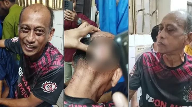 অভিনেতা সমু চৌধুরীর ওপর হামলা, মাথায় পড়েছে সেলাই
