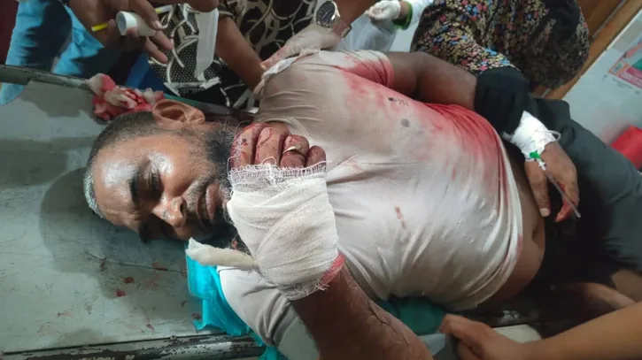 লং মার্চ থেকে ফেরার পথে সিরাজগঞ্জে জামায়াতের সাবেক ইউনিয়ন আমিরকে কুপিয়ে জখম, অভিযোগে বিএনপি