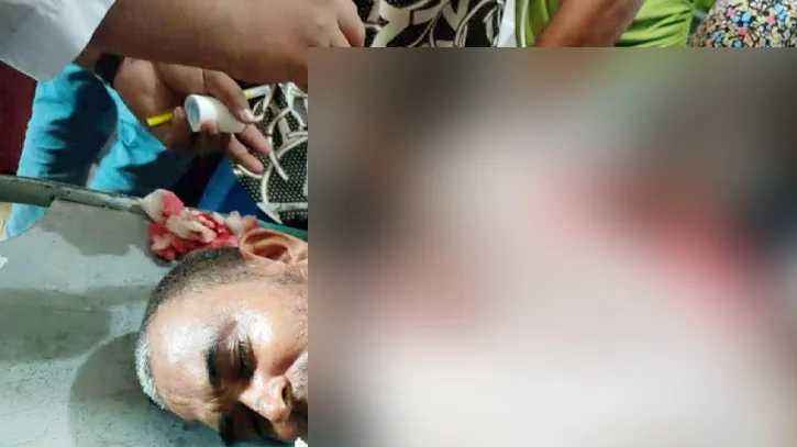 সিরাজগঞ্জে জামায়াত নেতাকে কুপিয়ে জখমের অভিযোগ, বিএনপি নেতাকর্মীদের বিরুদ্ধে মামলা